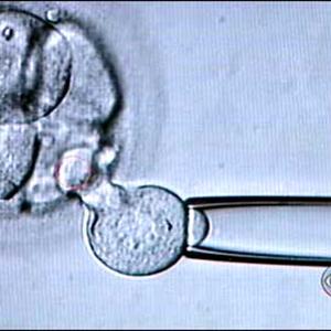 Ovulation Conception Blastocyst - Male Infertility Tips