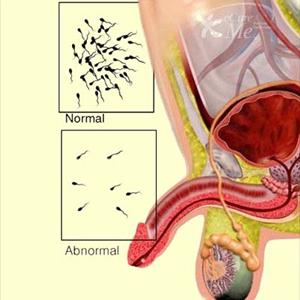 Fertility Issues Pregnancy - Infertility Problem - 4 Natural Remedies That Will Render Infertility Null And Void!